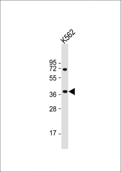 BLVRA Antibody (C-term)