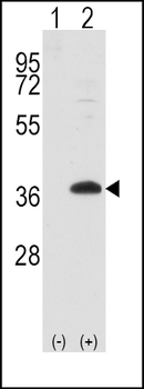 FRAT1 Antibody (Center)