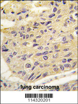 FRAT1 Antibody (Center)