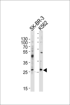 FRAT1 Antibody (C-term)