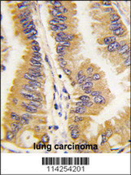 FRAT1 Antibody (C-term)