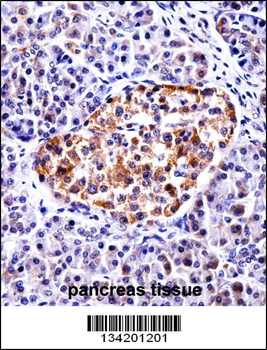 TAC3 Antibody (Center)