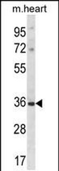 DLX5 Antibody (Center)