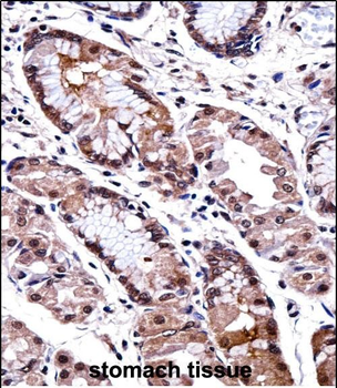 DLX5 Antibody (Center)