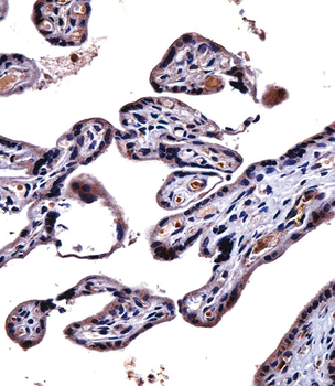 IL9R Antibody (Center)