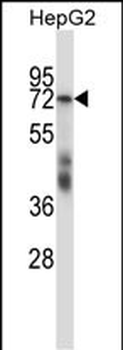 SF1 Antibody (Center)