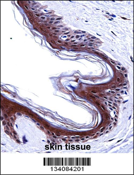 SMARCE1 Antibody (C-term)