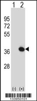 TOLLIP Antibody (C-term)