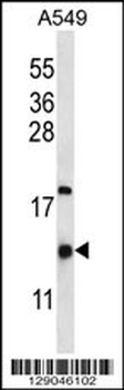 HIGD2A Antibody (N-term)