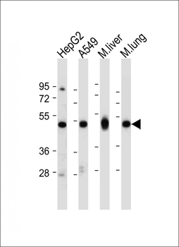 ALDH2 Antibody (Center)