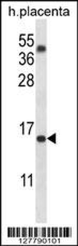 TM4SF18 Antibody (Center)