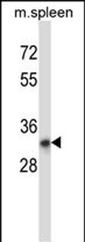 TATDN1 Antibody (Center)