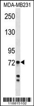 Myeloperoxidase Antibody (Center)