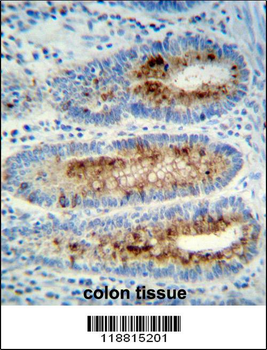 Myeloperoxidase Antibody (Center)