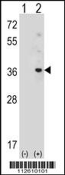 APG10L Antibody (C-term S116)