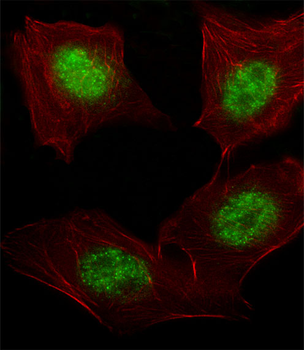 ARNT Antibody (Center V528)