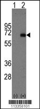 AFP Antibody (Center)