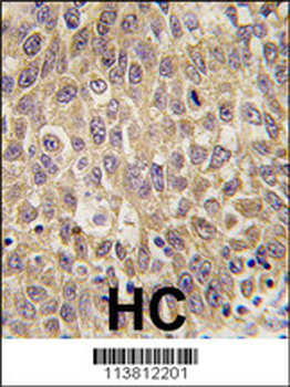 AFP Antibody (N-term)
