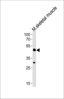 Mouse Hoxc10 Antibody (C-term)