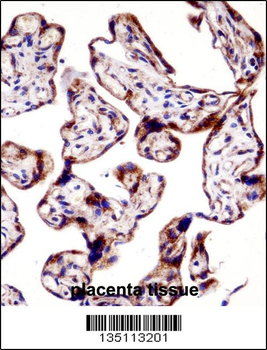 TEAD3 Antibody (N-term)