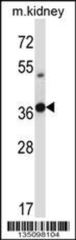 Mouse Tssk6 Antibody (C-term)