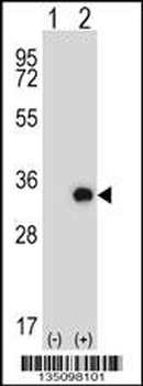 Mouse Tssk6 Antibody (C-term)