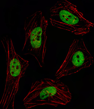 PITX2 Antibody (C-term)