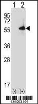 Mouse Sgk3 Antibody (C-term)