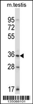 Mouse Sgk110 Antibody (C-term)