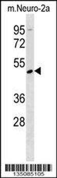 Mouse Rage Antibody (N-term)