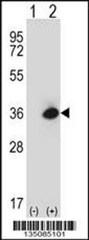 Mouse Rage Antibody (N-term)