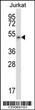 Mouse Cdk15 Antibody (N-term)
