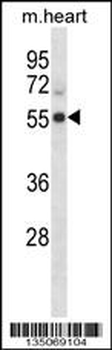 Mouse Cdk15 Antibody (N-term)