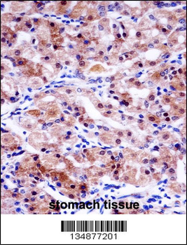 USP43 Antibody (C-term)