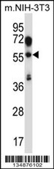 TEAD2 Antibody (Center)