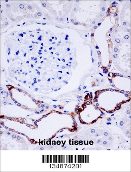 OTU7B Antibody (C-term)