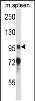 Mouse Ptk2b Antibody (Center)