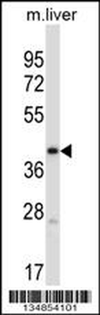Mouse Pdk3 Antibody (C-term)