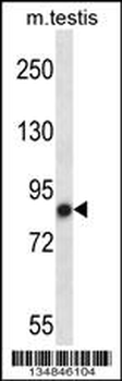 Mouse Nek4 Antibody (N-term)
