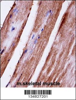 Mouse Mapk3 Antibody (C-term)