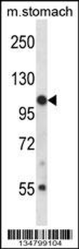 Mouse Jak3 Antibody (N-term)