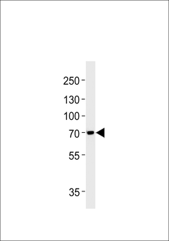 TAU (MAPT) Antibody (S720)