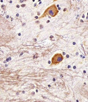 TAU (MAPT) Antibody (S720)