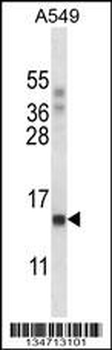 POLR2J Antibody (C-term)