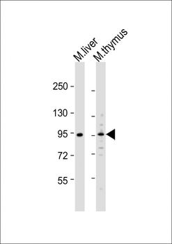 Mouse Ern1 Antibody (C-term)