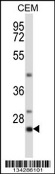 LIME1 Antibody (C-term)