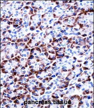 CCDC50 Antibody (Center)