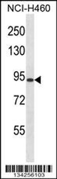 RGS9 Antibody (N-term)