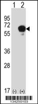 DPYSL3 Antibody (C-term)