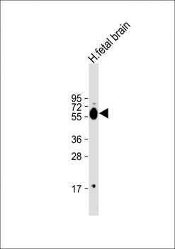 DPYSL3 Antibody (C-term)